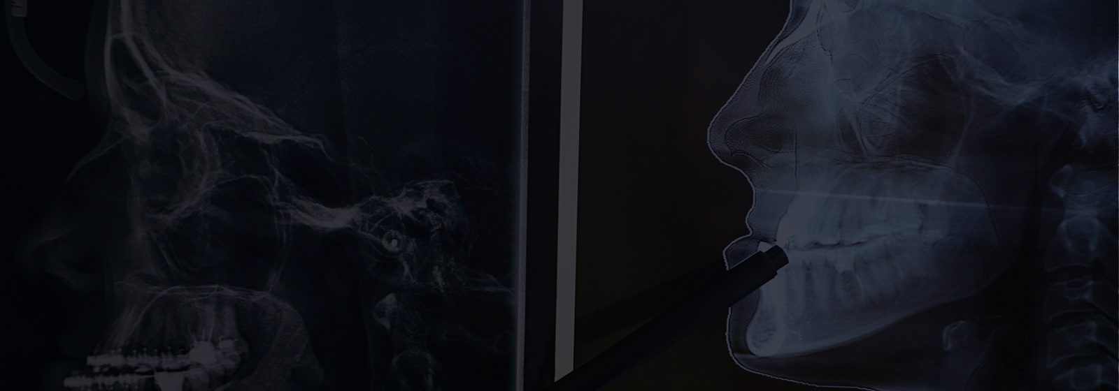 image banner