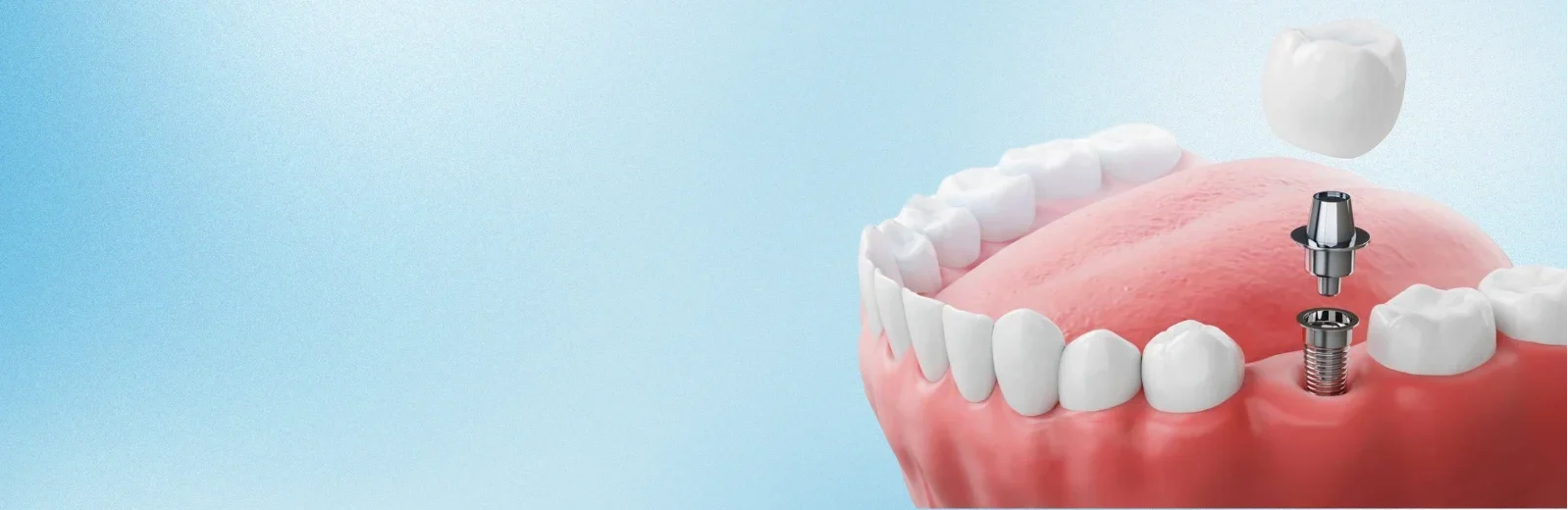 image banner